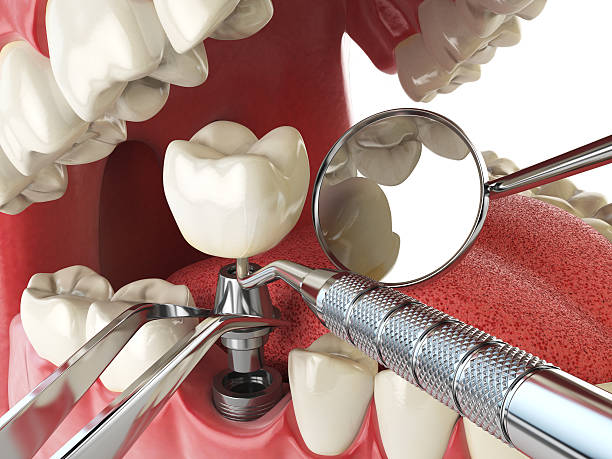 Best Emergency Treatment for Toothache in North Browning, MT